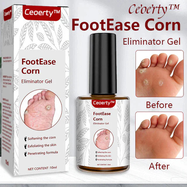 Feet Corn Removal Serum BUY 1 GET 1 FREE